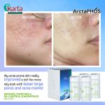 ArctaPHOS Refining, Purifying & Oil control Concentrate (8ML x 4pcs)