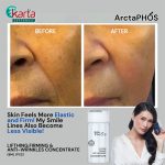 ArctaPHOS Lifting, Firming & Anti-Wrinkles Concentrate (8ML)