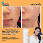 ArctaPHOS Renewing, Lightening & Brightening Concentrate (8ML x 4pcs)