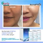 ArctaPHOS Repairing, Illuminating & Deep Moisturizing Concentrate (8ML x 4 pcs)