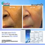 ArctaPHOS Lifting, Firming & Anti-Wrinkles Concentrate (8ML x 4pcs)