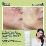 ArctaPHOS Refining, Purifying & Oil control Concentrate (8ML)