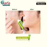 Nixoderm Acne Gel 20ml